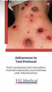 What Determines the Accuracy of Syphilis Home Test Kits #JalMedicalSingaporePteLtd