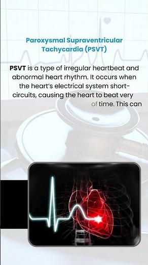 Let Us Discover What PSVT Is | Dr. Arun Explains PSVT Causes, Symptoms & Treatment