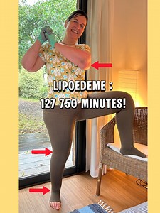 48K views · 139 reactions | Le lipœdème implique de porter des bas de...