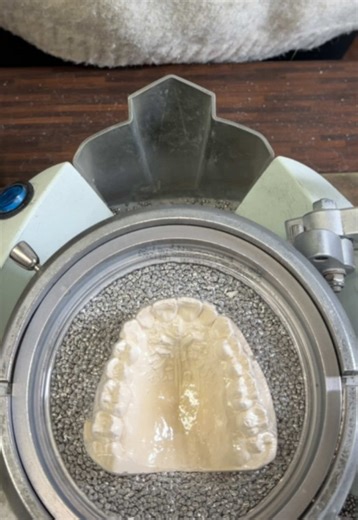 Understanding Retainers for Dental Health