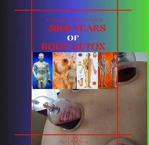 Hijama Cupping Therapy Guide: Ancient Detox Method - Etsy