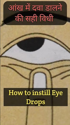 How to Apply Eye Drops (The Right Way)