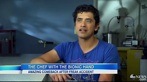Chef Eduardo Garcia Does Not Let Bionic Hand Stop Him