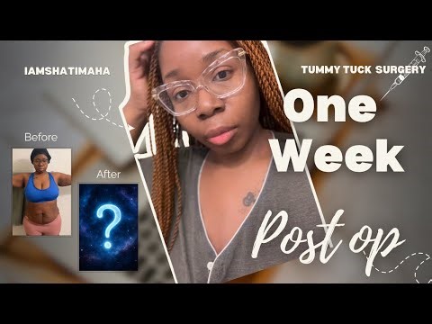 1 WEEK POST OP TUMMY TUCK RECOVERY VLOG