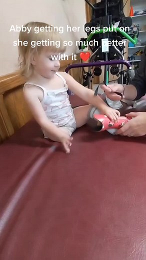 Abby's Amazing Progress with Prosthetic Leg | Heartwarming Story