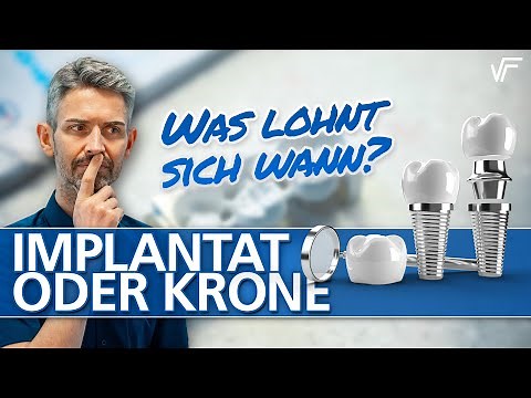 Zahnersatz - Implantat vs. Krone