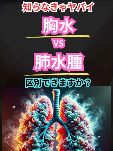 医療従事者必見！胸水と肺水腫の違い