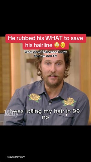 Minoxidil: The Truth Behind Hair Loss Treatments