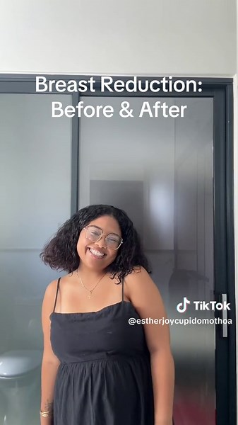 Before and After Breast Reduction: Best Decision Ever!