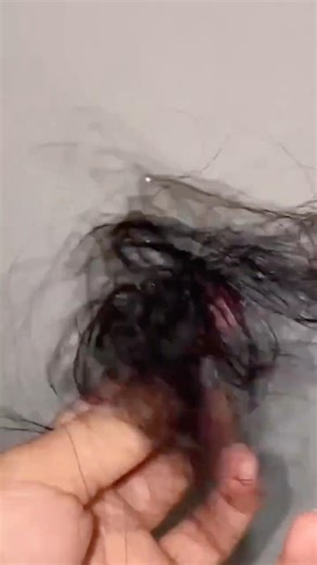 Hair falling out? Look at this!
