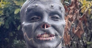 «Black Alien» n’a pas fini de se transformer: après le nez et les oreilles, le Français se fait retirer la lèvre supérieure (photos)