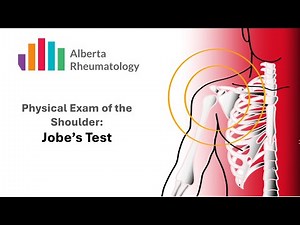 Jobe's Test or Empty Can Test: Rheumatology Shoulder Physical Exam Special Tests