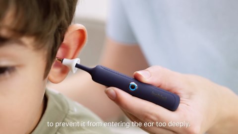 Bebird Earsight Plus R37R Ear Cleaning Camera Wax Removal Tool kit, FSA HSA Eligible Flexible Ear Scope Otoscope Camera Light, Visual Ear Picker Wireless Earwax Remover Tweezers for Adults & Kids