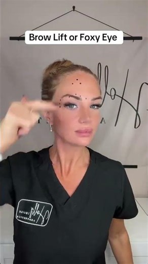 how to inject to eyebrow lift