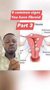 11K views · 123 reactions | 8 common signs of fibroid part 3 | Dr. Oxford1 | Facebook
