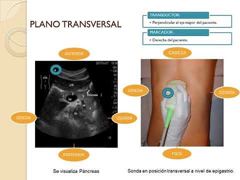 3.- PLANOS ECOGRÁFICOS