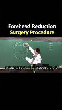 How Forehead Reduction Surgery Works