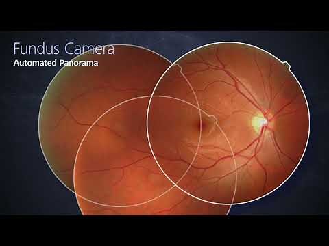 NIDEK RETINA SCAN DUO™ 2