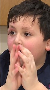Family warns parents after toy explosion leaves 9-year-old severely burned