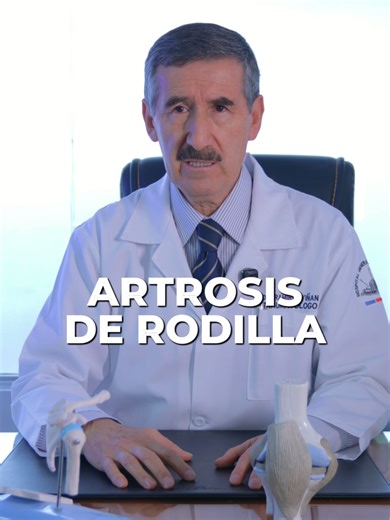 Artrosis de rodilla: Síntomas, tratamiento y PRP