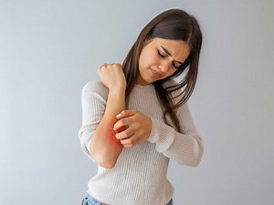 What Is Psoriasis: Symptoms, Diagnosis, Causes & Treatment - MFine