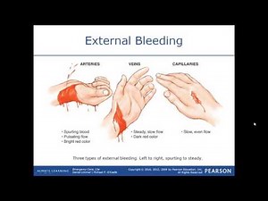 Bleeding and Shock for the EMT
