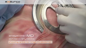 Advanced Skin Recovery with the Amalgatome MD