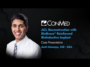 Dr. Amit Momaya - PRESENTATION (2025): ACL Reconstruction with the BioBrace® Implant