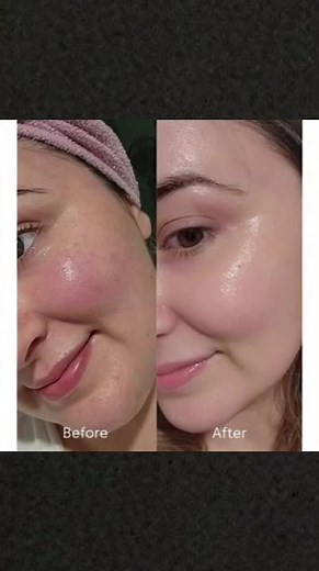 Clear Skin DIY Mask | Turmeric + Basil Seeds + Honey ✨