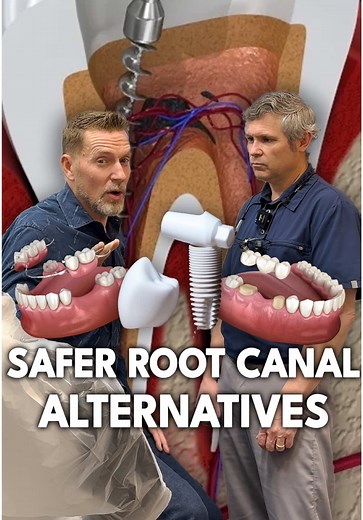 Safer Alternatives to Root Canals: Exploring Removable Partial Dentures, Traditional Bridges, and Ceramic Implants