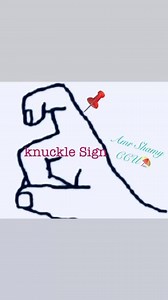 2.1K views · 23 reactions | ♌️ What’s Knuckle Sign Refers to ⁉️...