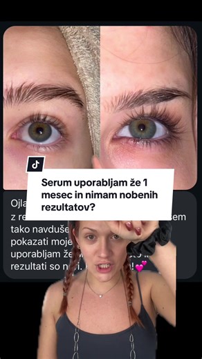 Po enem mescu uporabe seruma za rast trepalnic ne vidim nobenih rezultatov?🤔 #activeluxecosmetics #eyelashes #eyelashgrowthserum #serum