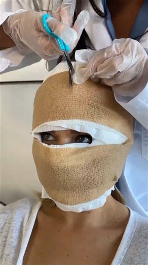 626K views · 1.6K reactions | Her face looked better before (Facial reconstruction surgery reveal) Doctor shows patient results of her surgery. This original video was produced by Network Media, Wes and Alison. | The Henderson Theater Troupe | Facebook