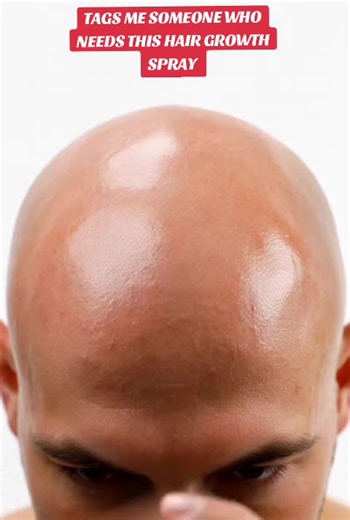 Transform Your Hair with This Powerful Growth Spray