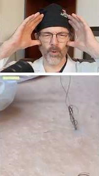 Plastic Surgeon Reacts to Extreme Ingrown Hair Pull! 😱