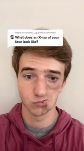 Reply to @random__guy169 Sorry, but I done have access to x-rays of my own face 😢#586 | Lukas Caldwell