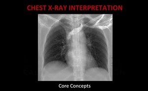 Chest X-Ray Techniques