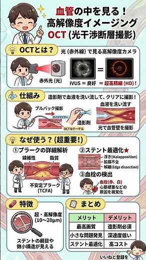 【心カテ技術】血管の中をHD画質で見抜く！「OCT（光干渉断層撮影）」の仕組みと臨床的メリット徹底解説｜不安定プラークの解析からステント最適化まで