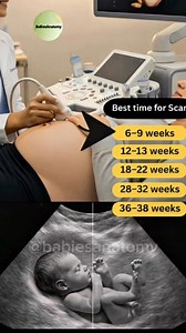 Best Time for Pregnancy Ultrasound Scan Weeks Guide for Moms-to-Be An ultrasound scan is an important part of pregnancy care. Each stage of pregnancy has a recommended time for scanning, helping healthcare providers monitor baby’s development, confirm growth milestones, and prepare for the weeks ahead. This visual shows the most common weeks for pregnancy scans, explained in a simple and easy-to-understand way, so parents know what to expect during each trimester. Always follow your healthcare p
