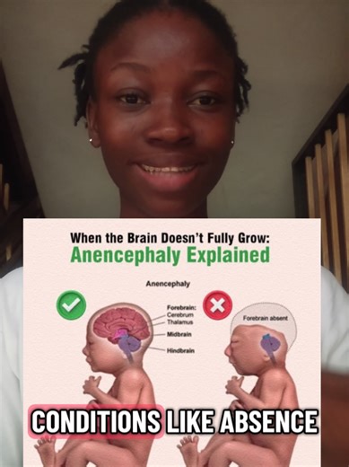 Understanding Birth Defects Leading to Breech Babies