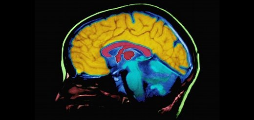 Top Ten Myths About the Brain