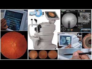 How to Capture High-Quality Fundus Images – Best Practices and Techniques