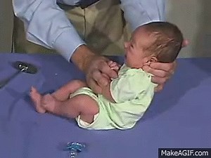 Moro Reflex on Make a GIF