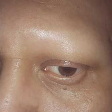 3D Microblading Brows WATCH THIS REVEAL Alopecia