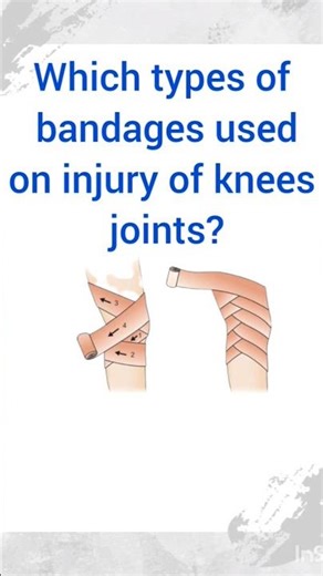 solve mcq paper ESIC previous mcq papernurs AIIMS nursing officernursing mcq questionsbest NORCET