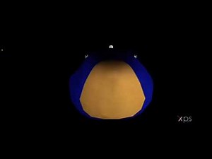 Sonic blows up like a balloon again (MOST POPULAR VIDEO!)