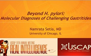 【中英双语字幕】Beyond H. pylori: Unusual Gastritides, Atrophy, and Metaplasia