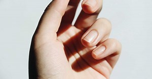 Onycholyse : définition, causes, symptômes et traitement du décollement de l’ongle