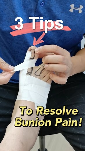 3 Effective Tips for Bunion Relief and Correction