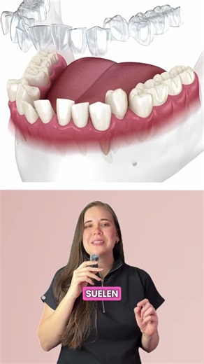 Not wearing your retainers? #dentist #braces #shortvideo #dentistry